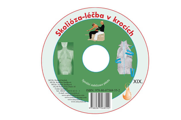 CD Skolióza - léčba v krocích