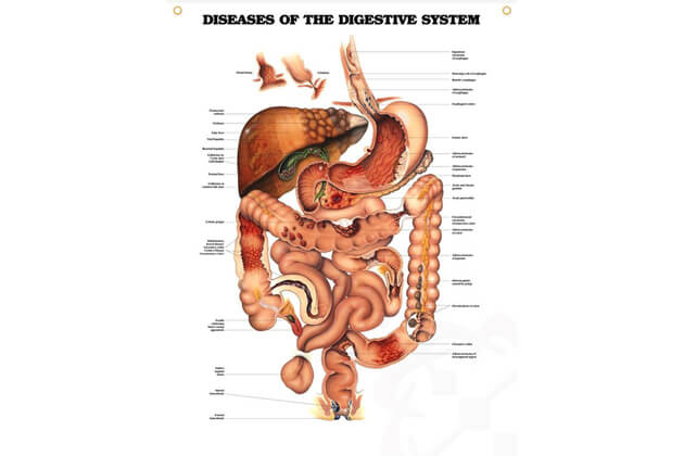Nemoci trávicího traktu 50,8x66cm