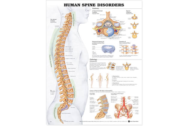Poruchy páteře 50,8x66cm